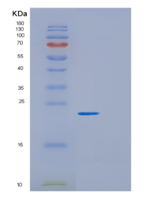 Recombinant Human GRPEL1 Protein