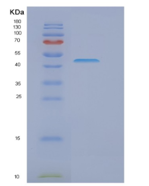 Recombinant Human GORASP2 Protein