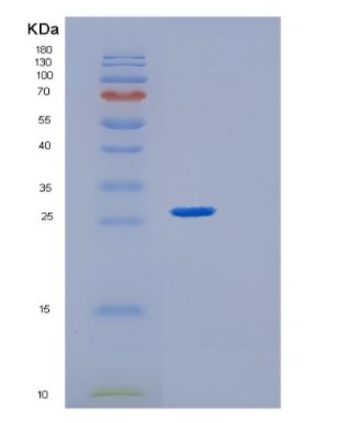 Recombinant Human GRB2 Protein