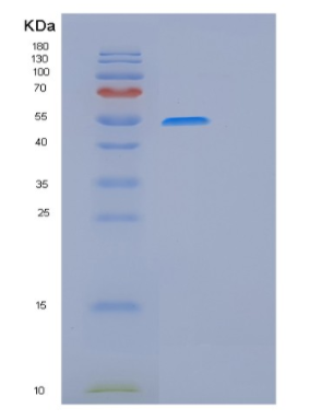 Recombinant Human GSS Protein