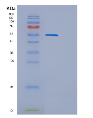 Recombinant Human GSR Protein