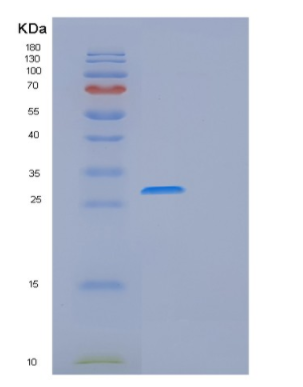 Recombinant Schistosoma japonicumGST Protein