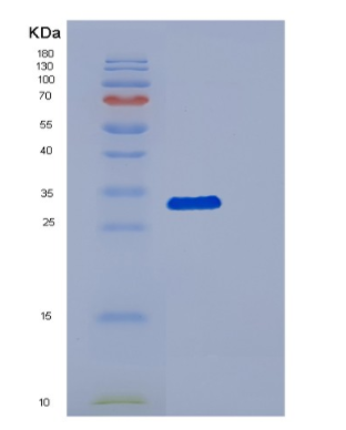 Recombinant Human DCAF7 Protein