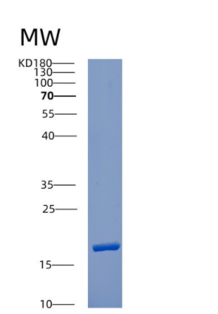 Recombinant Human CUTA Protein