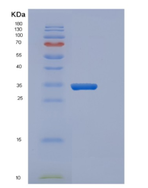 Recombinant Human CYB5R3 Protein