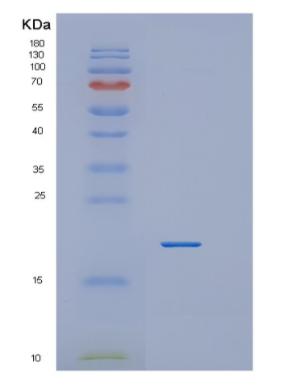 Recombinant Human Cyclophilin H(PPIH) Protein