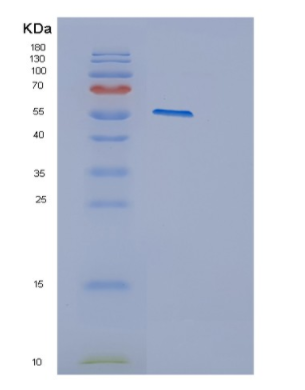 Recombinant Human CYP2E1 Protein