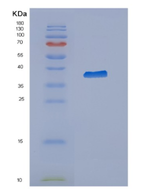 Recombinant Human CYTH3 Protein