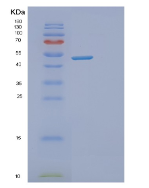 Recombinant Human DPH2 Protein