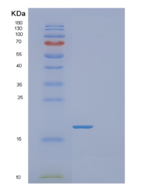 Recombinant Human FABP2 Protein