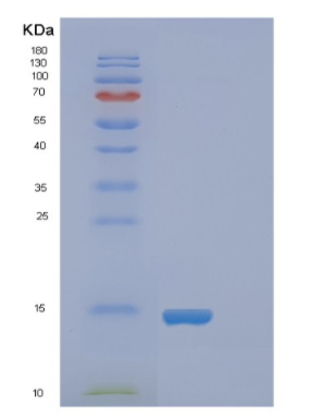 Recombinant Human FABP4 Protein