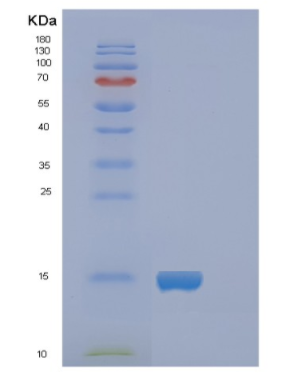 Recombinant Human FABP5 Protein