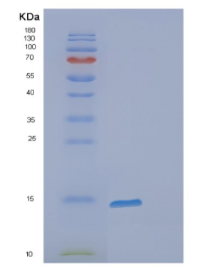 Recombinant Human FABP7 Protein