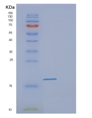 Recombinant Human FABP9 Protein
