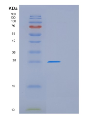 Recombinant Human GSTA1 Protein