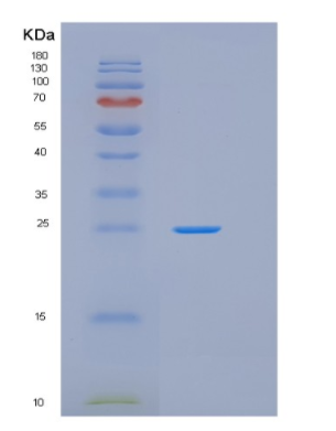 Recombinant Human GSTK1 Protein