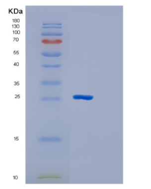 Recombinant Mouse GSTM1 Protein