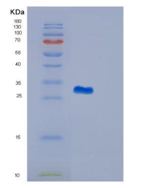 Recombinant Human GSTM4 Protein