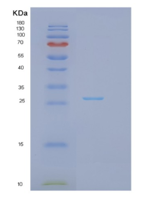 Recombinant Human GSTP1 Protein