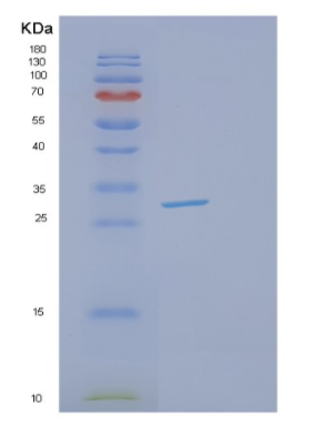 Recombinant Human GSTT2 Protein