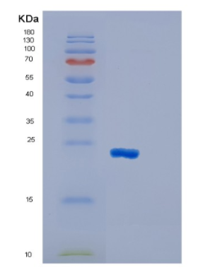 Recombinant Human GSTM1 Protein