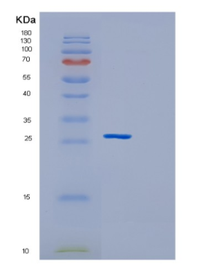 Recombinant Human GSTM2 Protein