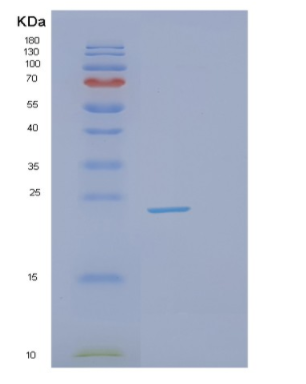 Recombinant Mouse GSTP2 Protein