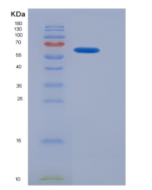 Recombinant General Transcription Factor IIA, Polypeptide 1 (GTF2A1)