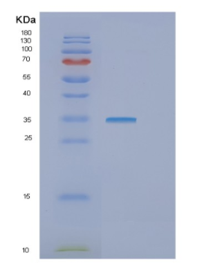Recombinant Human GTF2E2 Protein