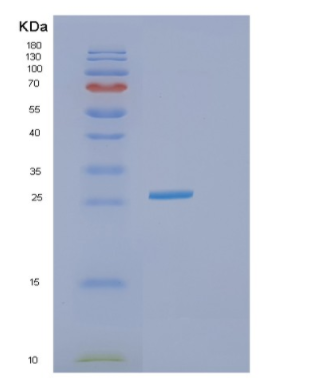 Recombinant Human GTF3C6 Protein