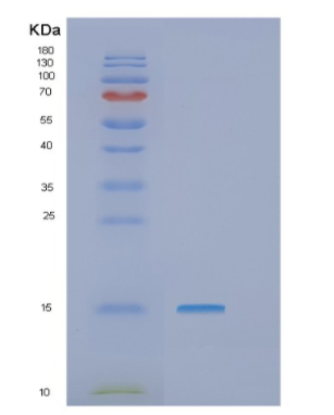 Recombinant Human GTLF3B Protein