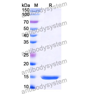 Anti-Influenza A virus/H1N1 NP/Nucleoprotein Nanobody (SAA1023)