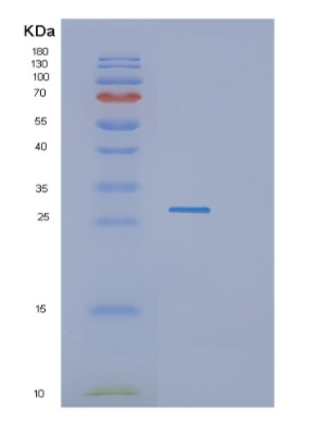 Recombinant Human GZMB Protein