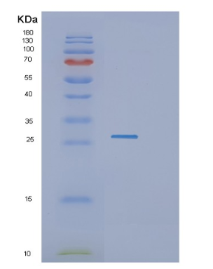 Recombinant Human GZMH Protein