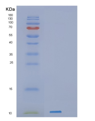 Recombinant Human H mgN1 Protein