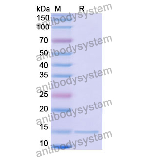 Anti-Human CD11a/ITGAL Nanobody (SAA1305)
