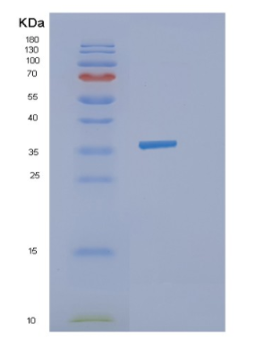 Recombinant Human Influenza A-H1N1/HA1 Protein