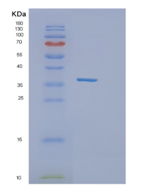 Recombinant Human Influenza A-H3N2/HA Protein