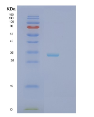 Recombinant Human HAGH Protein