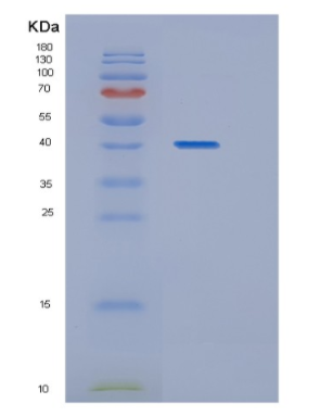 Recombinant Human HAT1 Protein