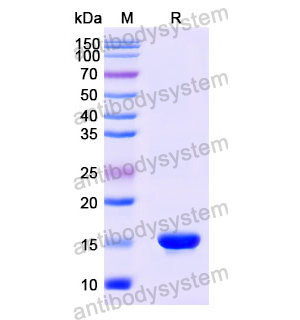 Anti-Human CD66e/CEA/CEACAM5 Nanobody (SAA1298)