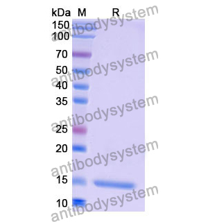 Anti-Human CD184/CXCR4 Nanobody (SAA1262)