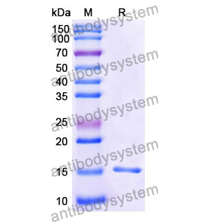 Anti-Human CD122/IL2RB Nanobody (SAA1051)