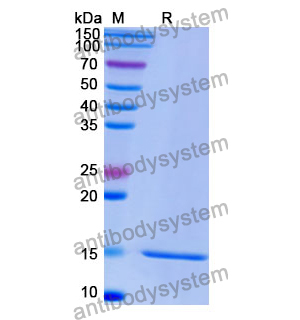 Anti-Human GPC3/Glypican 3 Nanobody (SAA1340)