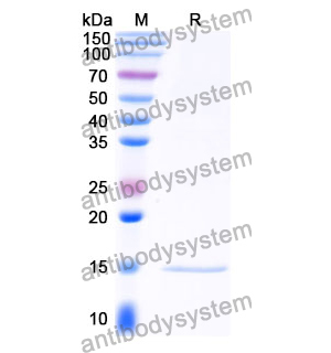 Anti-Clostridium botulinum botA/BOTOX Nanobody (SAA0935)