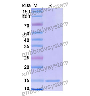 Anti-Human NOTCH1 Nanobody (SAA1286)