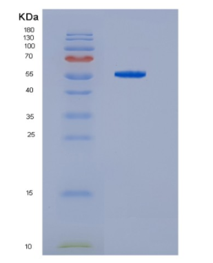 Recombinant Human HDAC2 Protein