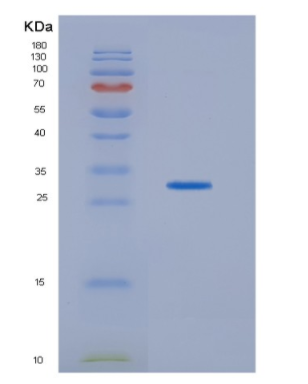 Recombinant Human HDHD2 Protein