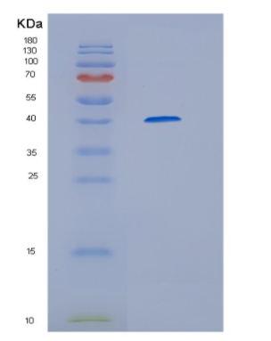 Recombinant Human HERC5 Protein