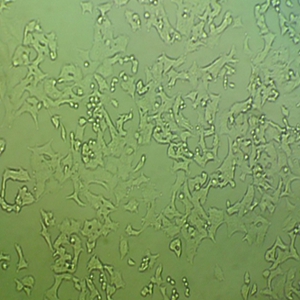 NCI-H1339人小细胞肺癌细胞
